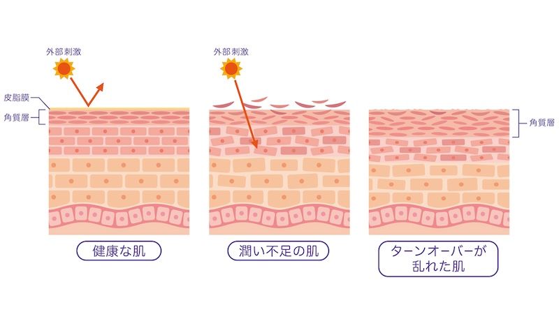 肌のターンオーバーが乱れると起こること