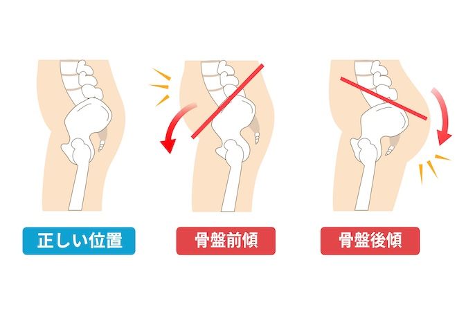 骨盤を締めるために鍛えたい筋肉とは？