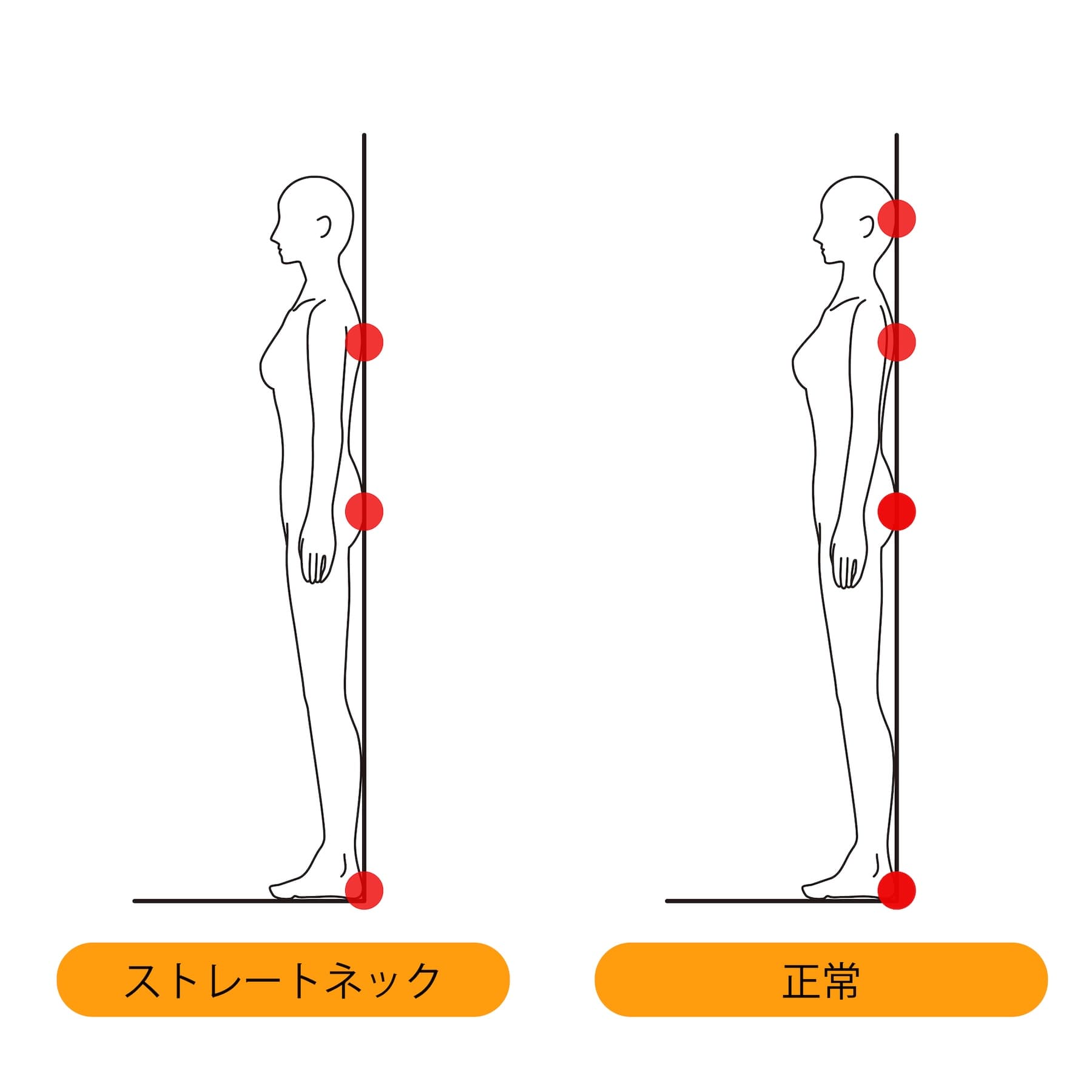 スマホ首のセルフチェック方法